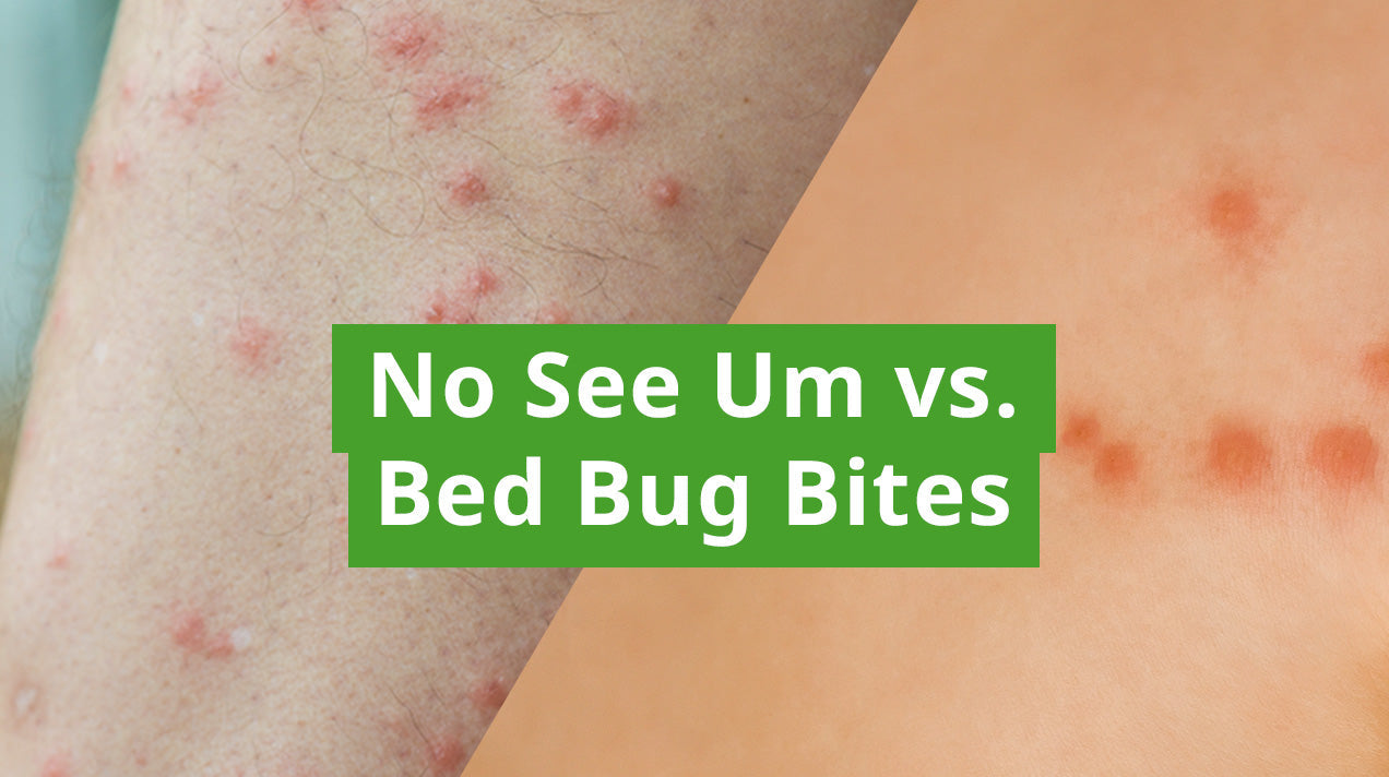 Woman Vs Insect No-See-Um Bites vs. Bed Bug Bites: How to Identify & Prevent Them ...