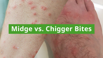 Midges vs. Chigger Bites: Identification, Prevention, and Treatment