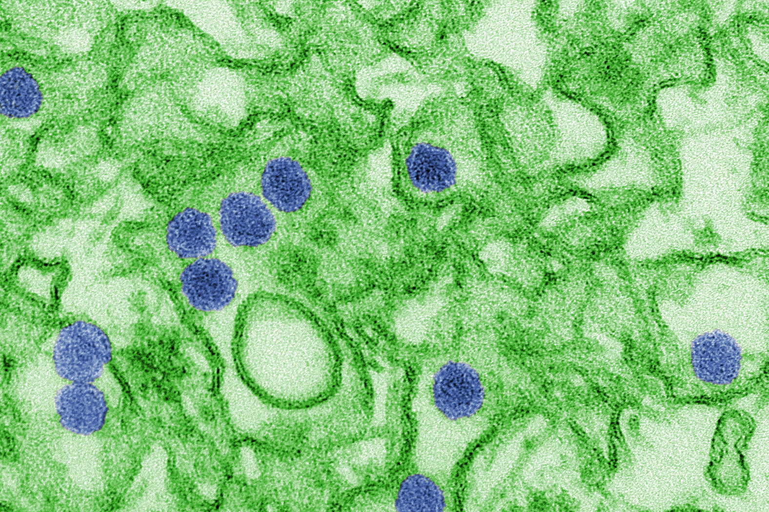 Microscope view of Zika virus